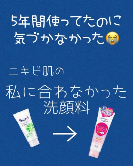 スキンケア洗顔料 薬用アクネケア/ビオレ/洗顔フォームを使ったクチコミ(1枚目)