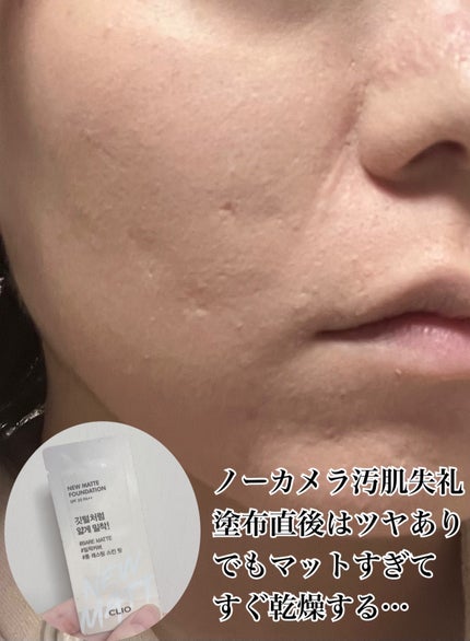 キルカバーニューマットファンデーション/CLIO/リキッドファンデーションを使ったクチコミ(1枚目)