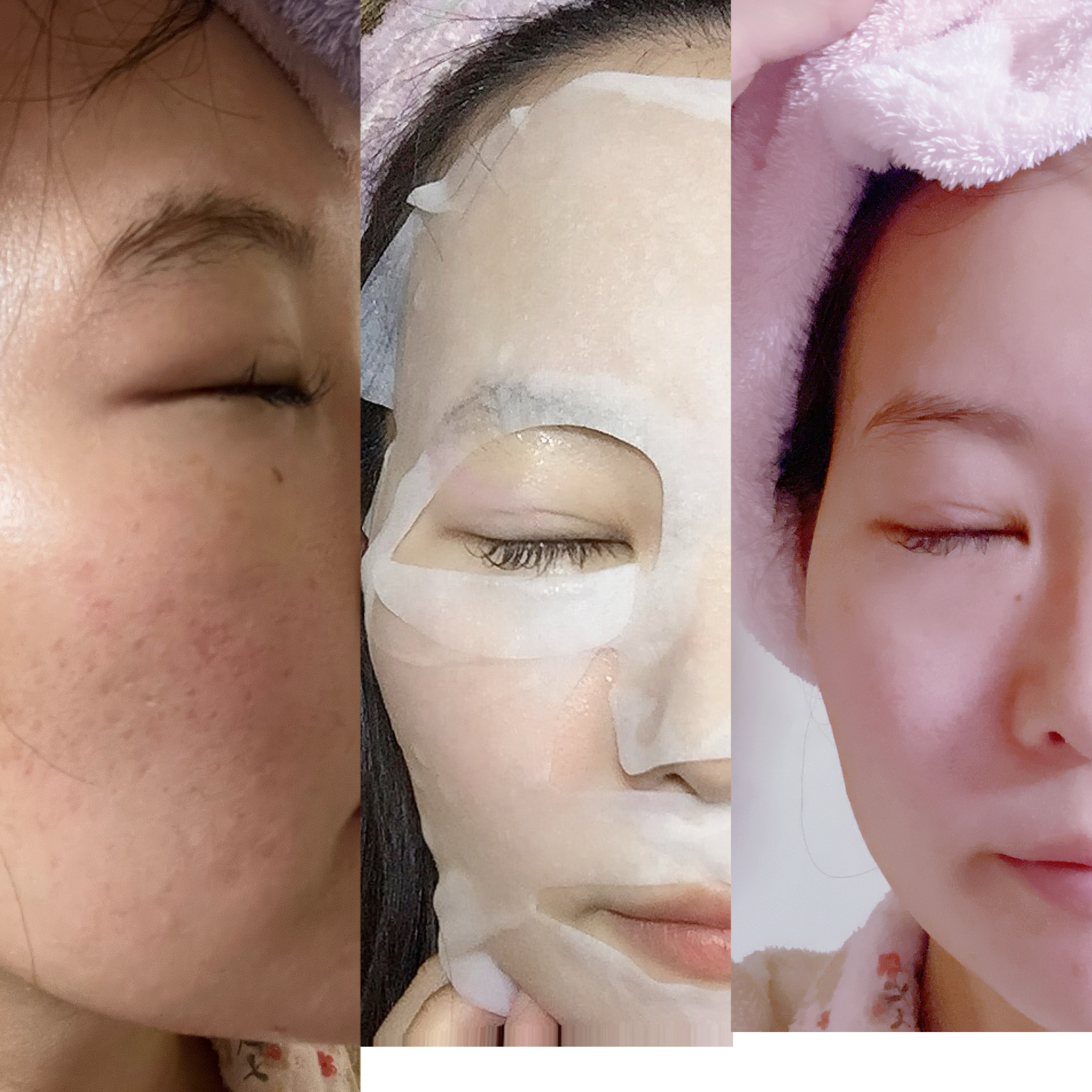 薬用リンクルフェイスマスク/akaran+/シートマスク・パックを使ったクチコミ（3枚目）