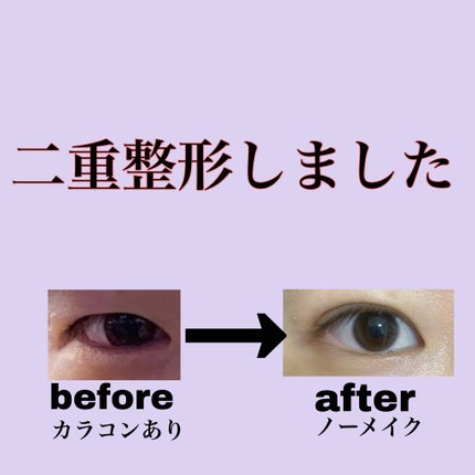 äºéæŽåœ¢/ãã®ä»ã䜿ã£ãã¯ãã³ãïŒ1æç®ïŒ