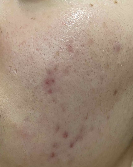 Cセラム/b.glen/美容液を使ったクチコミ(3枚目)