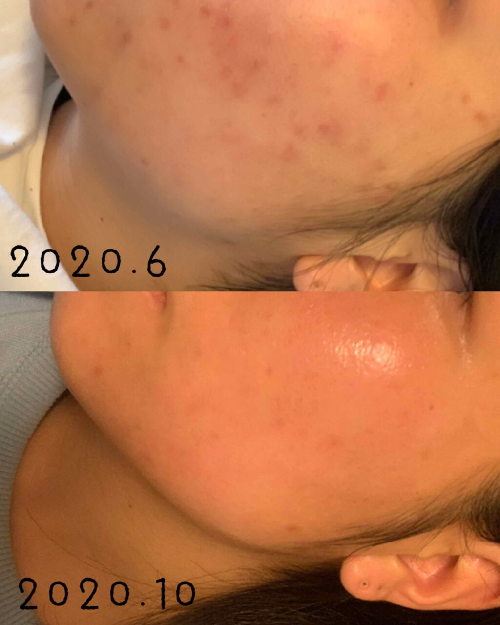 ミノン アミノモイスト モイストチャージ ミルク/ミノン/乳液を使ったクチコミ(2枚目)