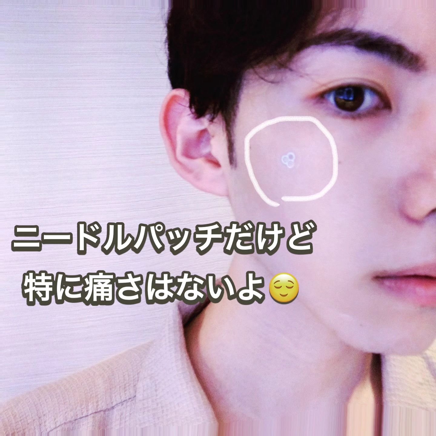 ACマグネシウムパッチ　ミニ/スノーツープラス/にきびパッチを使ったクチコミ（3枚目）