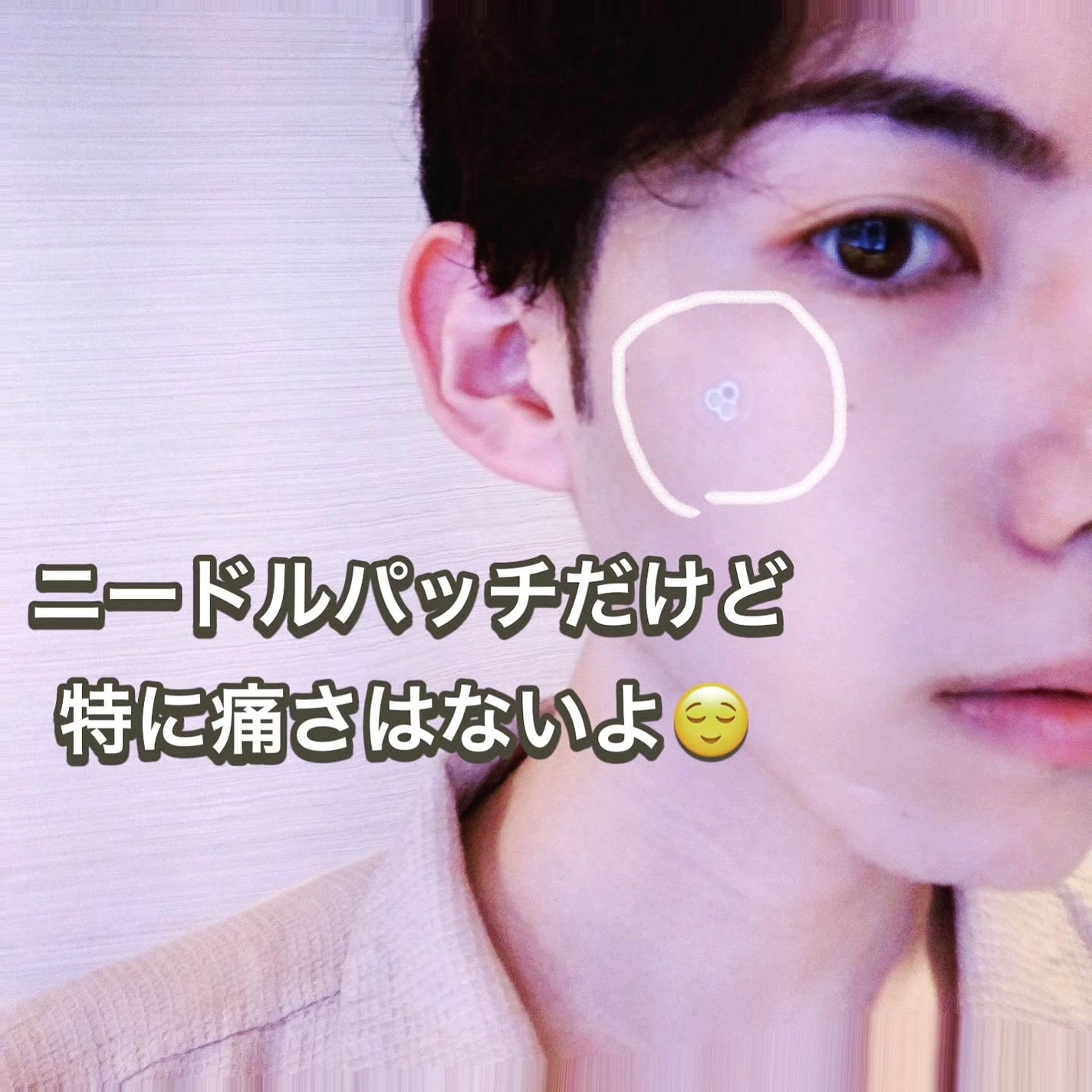 ACマグネシウムパッチ ミニ/スノーツープラス/にきびパッチを使ったクチコミ(3枚目)