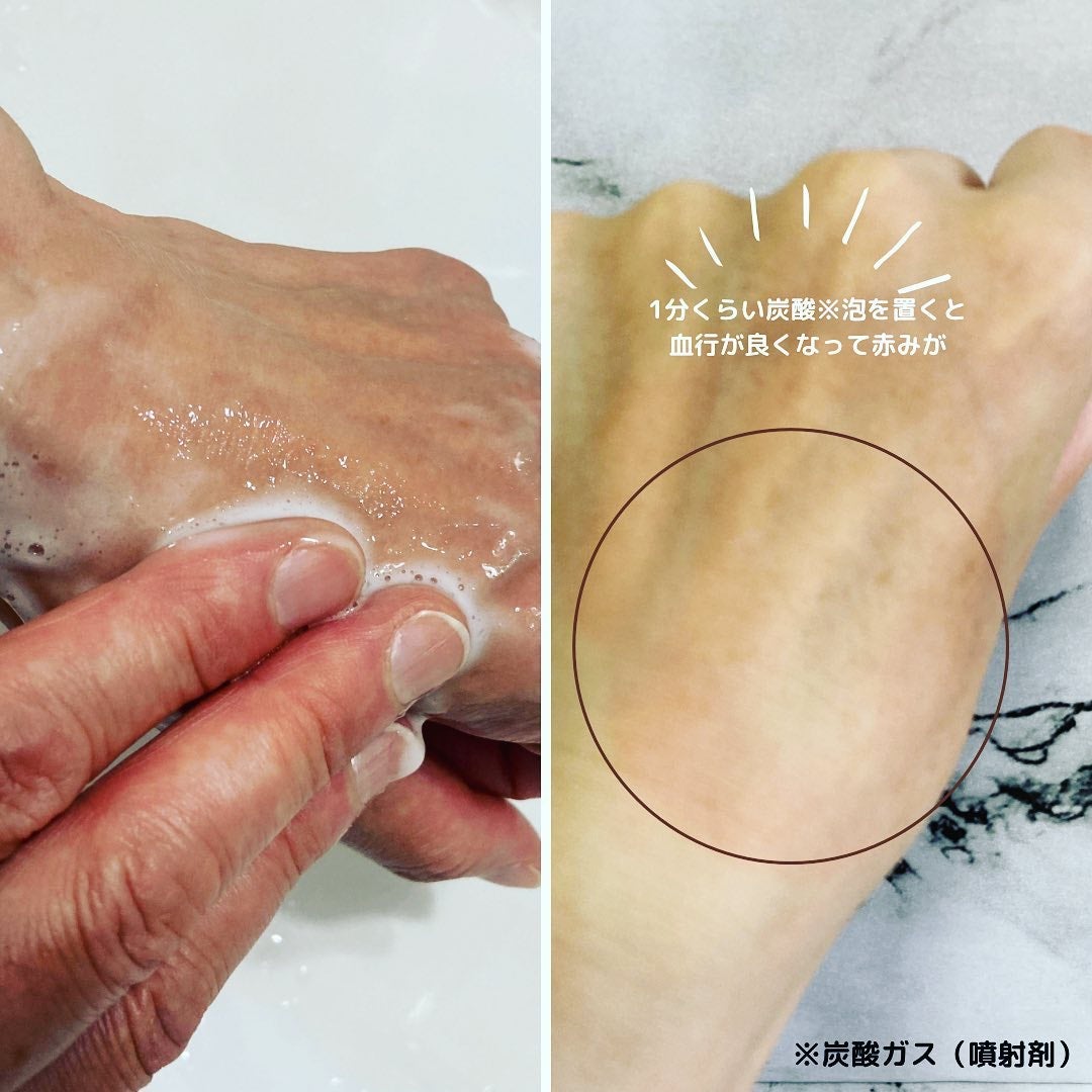 マイクロムース リフレッシャー/ALBLANC/泡洗顔を使ったクチコミ(7枚目)