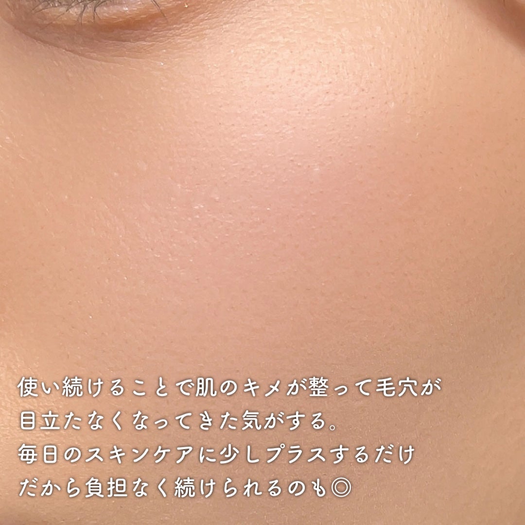 リードルS 100 2ステップマスク/VT/シートマスク・パックを使ったクチコミ(4枚目)