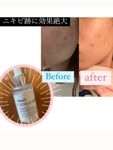 フレッシュリージュースドビタミンドロップ(35ml)/Klairs/美容液を使ったクチコミ(1枚目)
