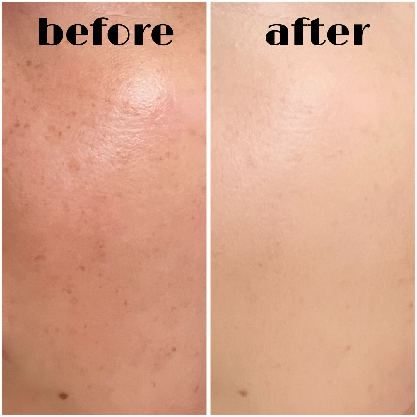 ジェリーカバーパクト/SISTER ANN/クリーム・エマルジョンファンデーションを使ったクチコミ(6枚目)