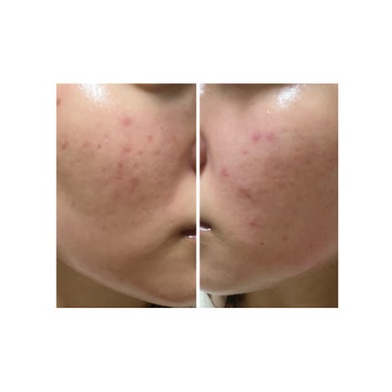 を使ったクチコミ(1枚目)