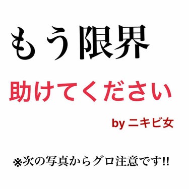 もも🦋 on LIPS 「見てくださりありがとうございます。みなさんに相談です😭皮膚科に..」（1枚目）