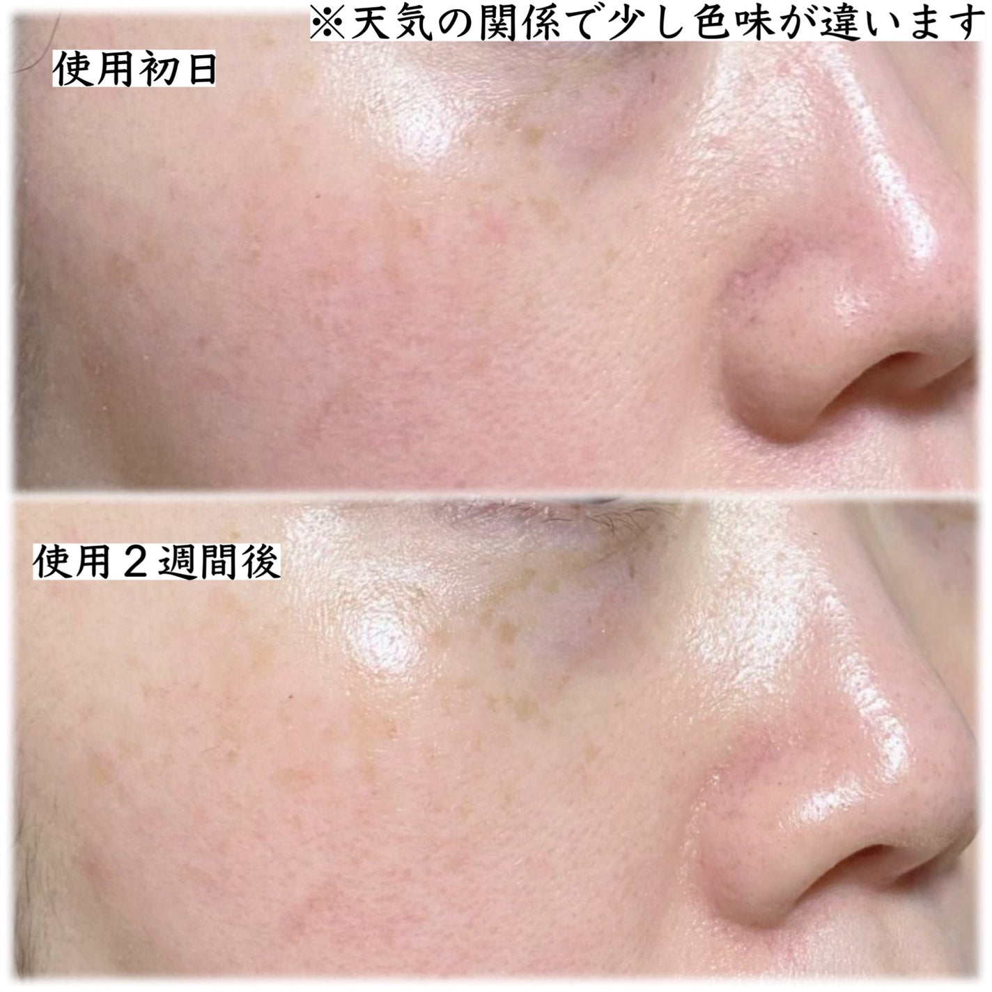 レチノコラーゲン低分子300パンピングアンプル/CKD/美容液を使ったクチコミ(4枚目)
