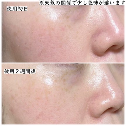 レチノコラーゲン低分子300パンピングアンプル/CKD/美容液を使ったクチコミ(4枚目)