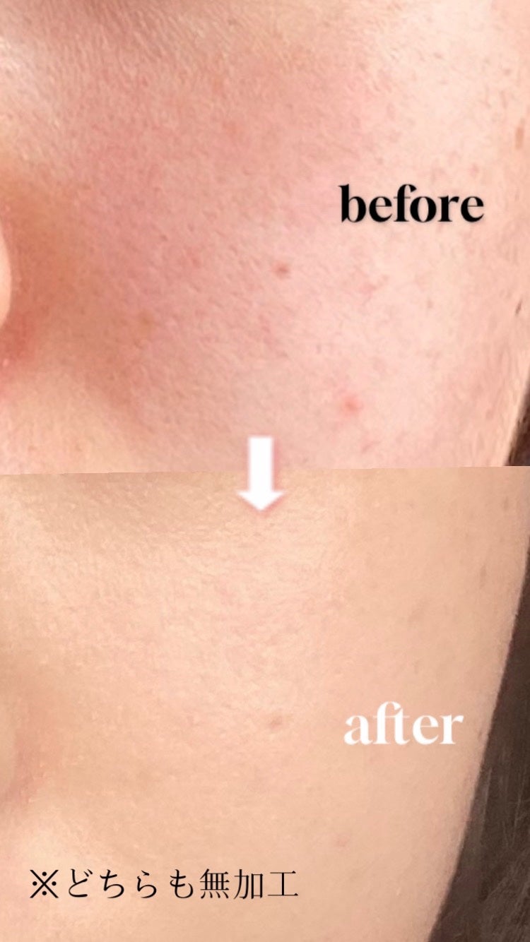 ネオクッション マット/LANEIGE/クッションファンデーションを使ったクチコミ(3枚目)