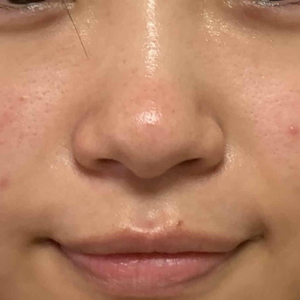 薬用 クリアローション M(しっとりタイプ)/オルビス/化粧水を使ったクチコミ（3枚目）