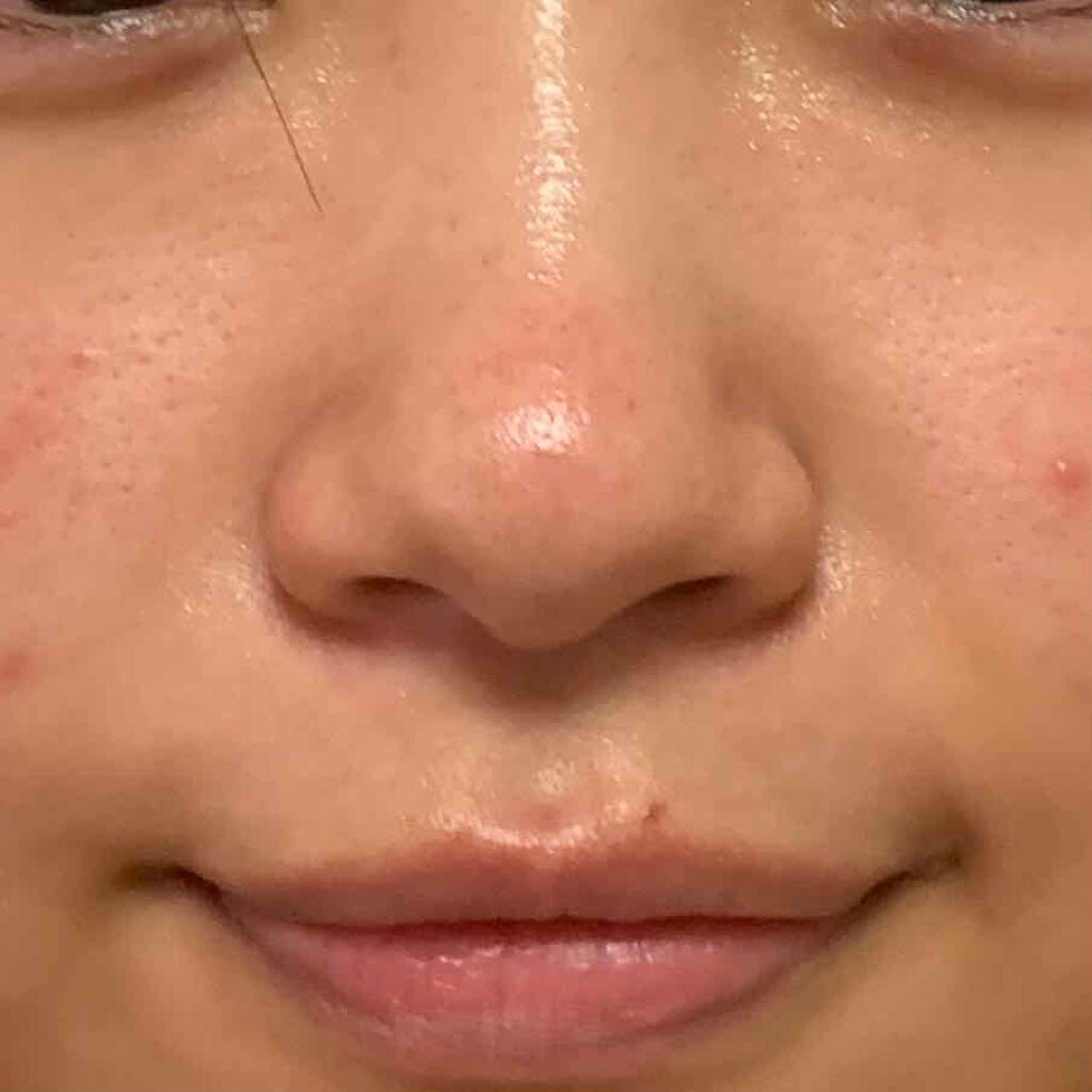 薬用 クリアローション M(しっとりタイプ)/オルビス/化粧水を使ったクチコミ(3枚目)