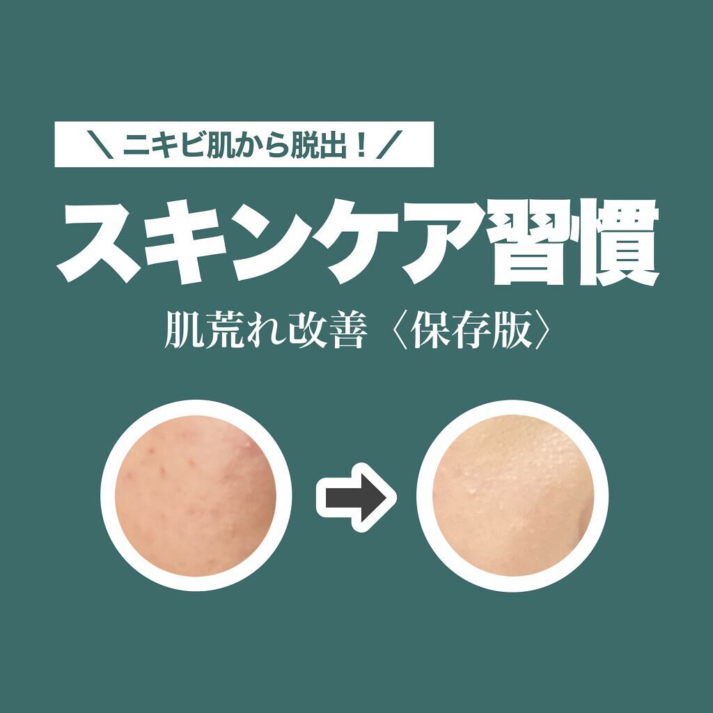 ウオーター/アベンヌ/ミスト状化粧水を使ったクチコミ（1枚目）