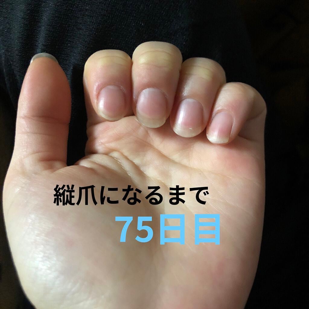 ð on LIPS ã瞊çªã«ãªãããã«ãããããªæ¹æ³ããã£ããæããŠãã ããð瞊çªã«..ãïŒ1æç®ïŒ