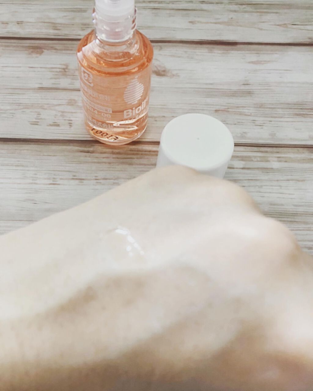 バイオイル/バイオイル/フェイスオイルを使ったクチコミ（3枚目）