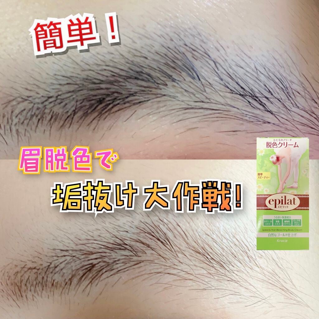 脱色クリーム スピーディー/エピラット/ムダ毛ケアを使ったクチコミ(1枚目)