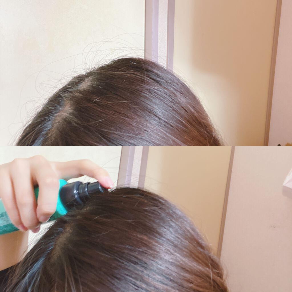 メディカルスカルプスパエッセンス/ティアレラプラス/頭皮ローションを使ったクチコミ（3枚目）