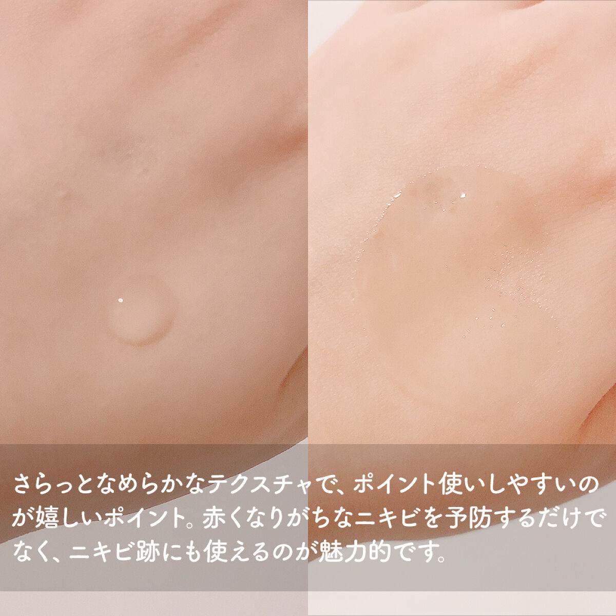 大人のニキビ対策 薬用クリアスポッツ美容液 /肌美精/美容液を使ったクチコミ（1枚目）