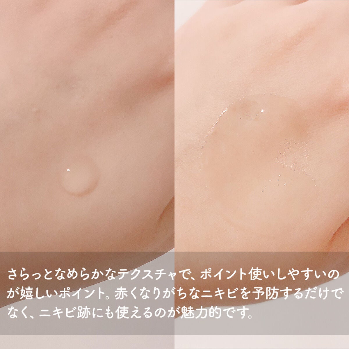 大人のニキビ対策 薬用クリアスポッツ美容液 /肌美精/美容液を使ったクチコミ(3枚目)