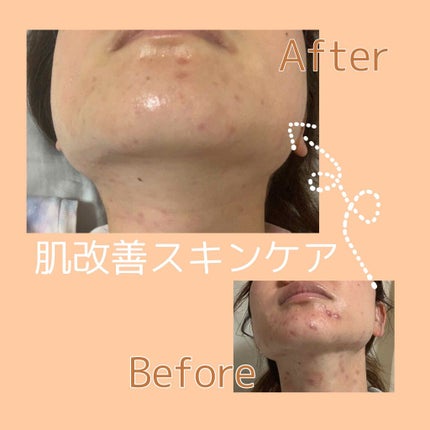 エクサージュホワイト ホワイトライズ ミルク/ALBION/乳液を使ったクチコミ(1枚目)