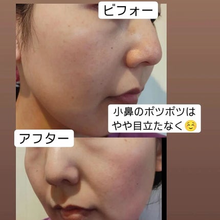 リードルショット300/VT/美容液を使ったクチコミ(4枚目)