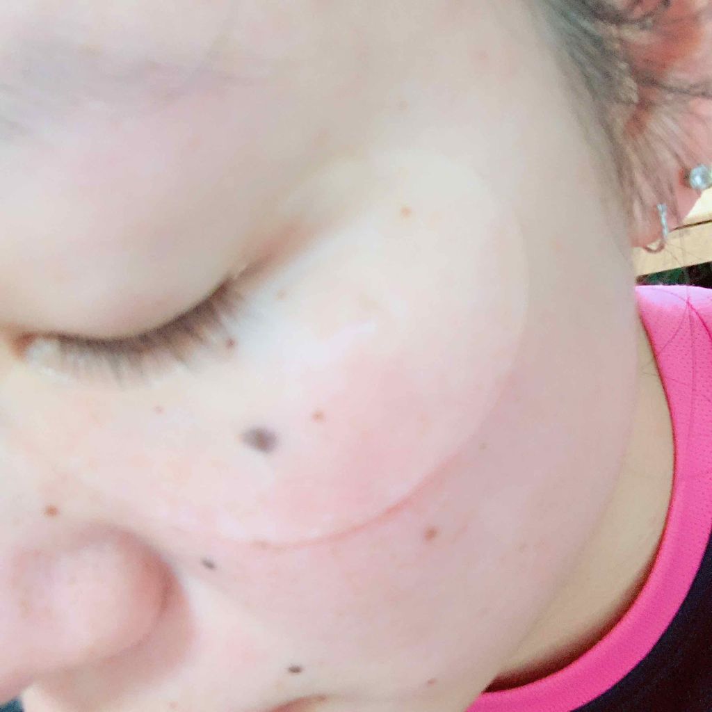 プレミアム ハイドロゲルアイパッチ/+OneC(プラワンシー)/アイケア・アイクリームを使ったクチコミ(3枚目)