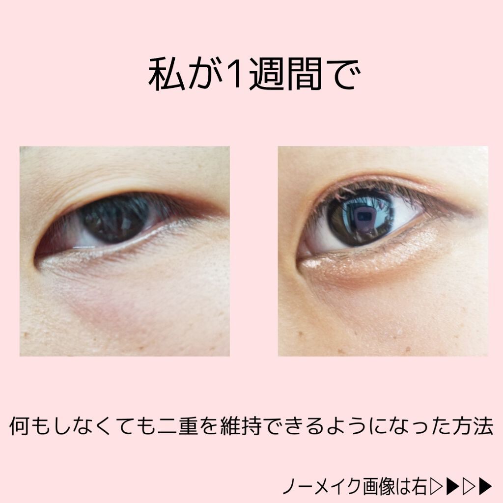 アイトーク/アイトーク/二重まぶた用アイテムを使ったクチコミ（1枚目）