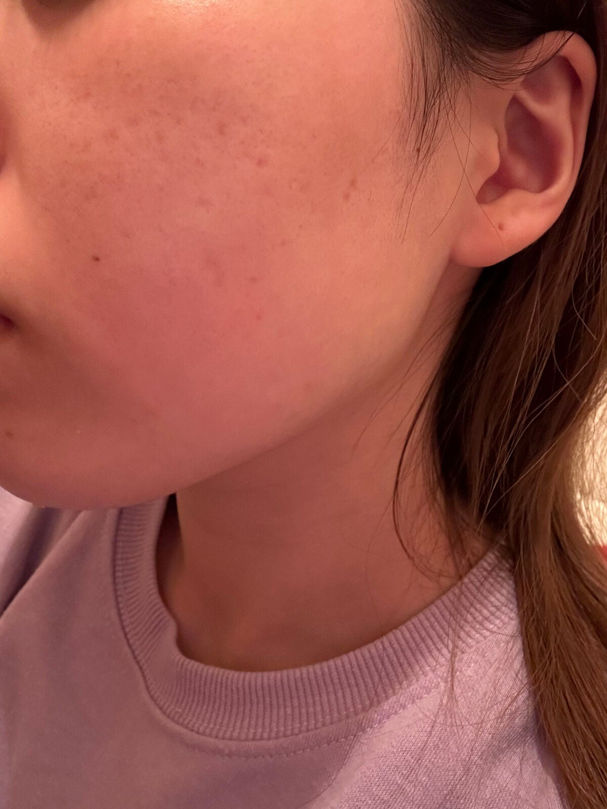 レチノールA 1% アドバンスドリバイタリゼーションクリーム/Life-flo/フェイスクリームを使ったクチコミ(4枚目)