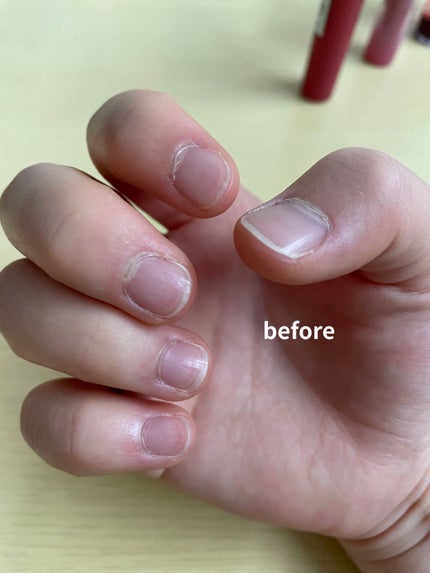 パーフェクトネイルコート/M・N・B・B/オールインワンネイルを使ったクチコミ(2枚目)