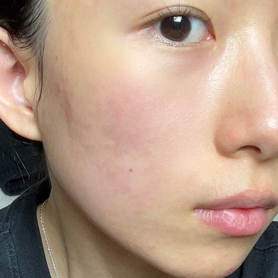 角質スッキリ毛穴パック /HANYUL(ハンユル)/洗い流すパック・マスクを使ったクチコミ(4枚目)