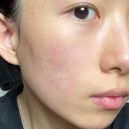 角質スッキリ毛穴パック /HANYUL(ハンユル)/洗い流すパック・マスクを使ったクチコミ(4枚目)