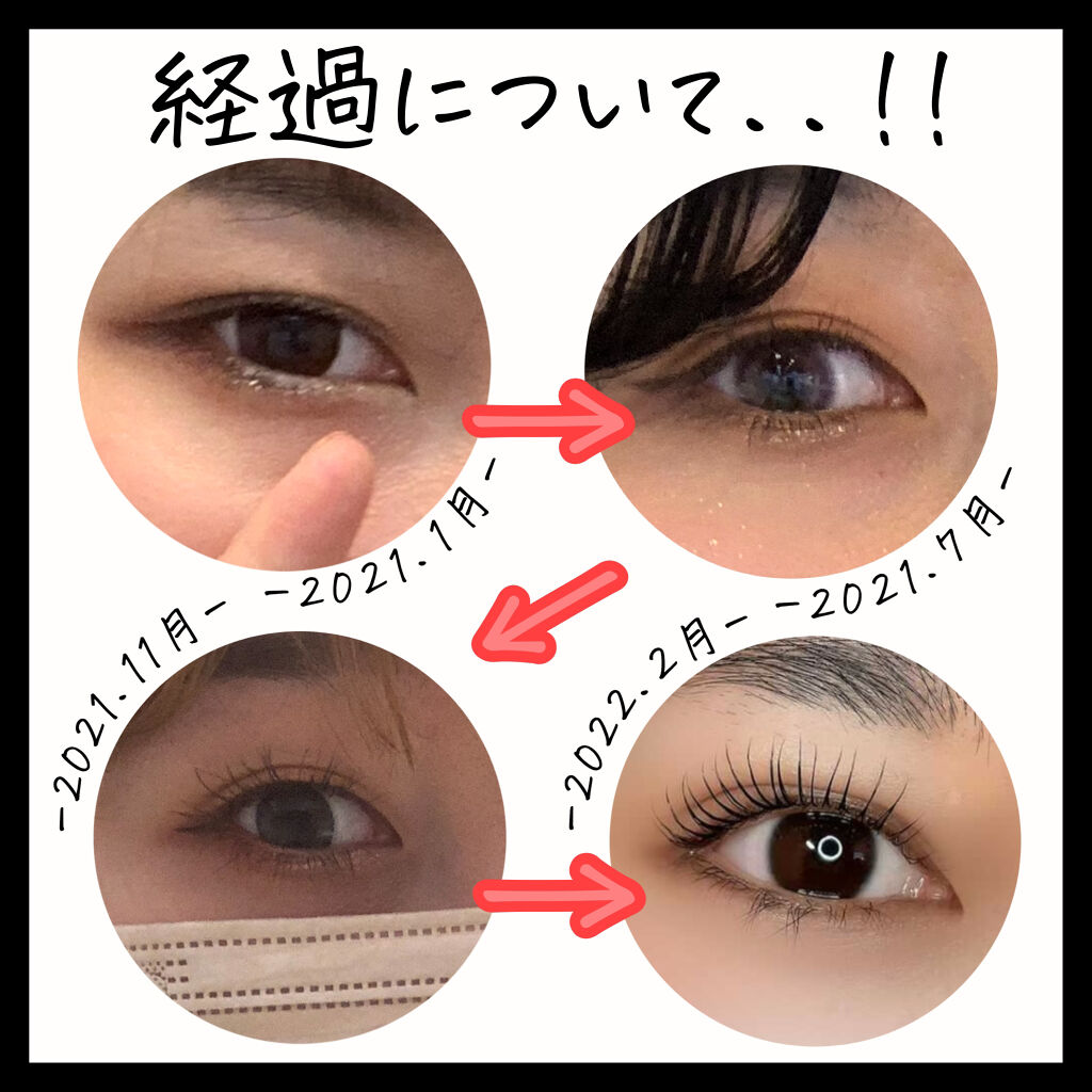 ラッシュアディクト アイラッシュコンディショニングセラム/soaddicted/まつげ美容液を使ったクチコミ（2枚目）