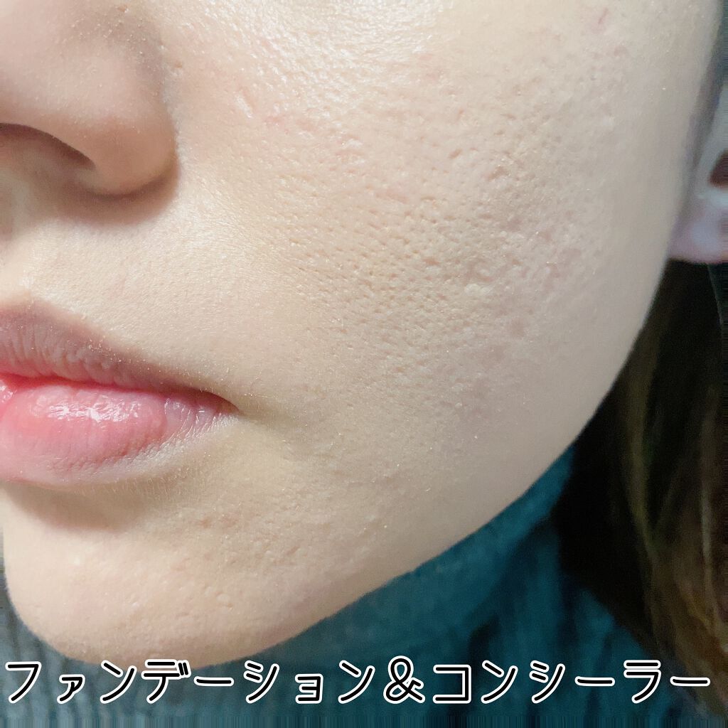 フィットミー コンシーラー/MAYBELLINE NEW YORK/リキッドコンシーラーを使ったクチコミ（3枚目）