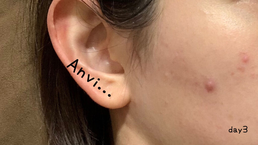 を使ったクチコミ（3枚目）