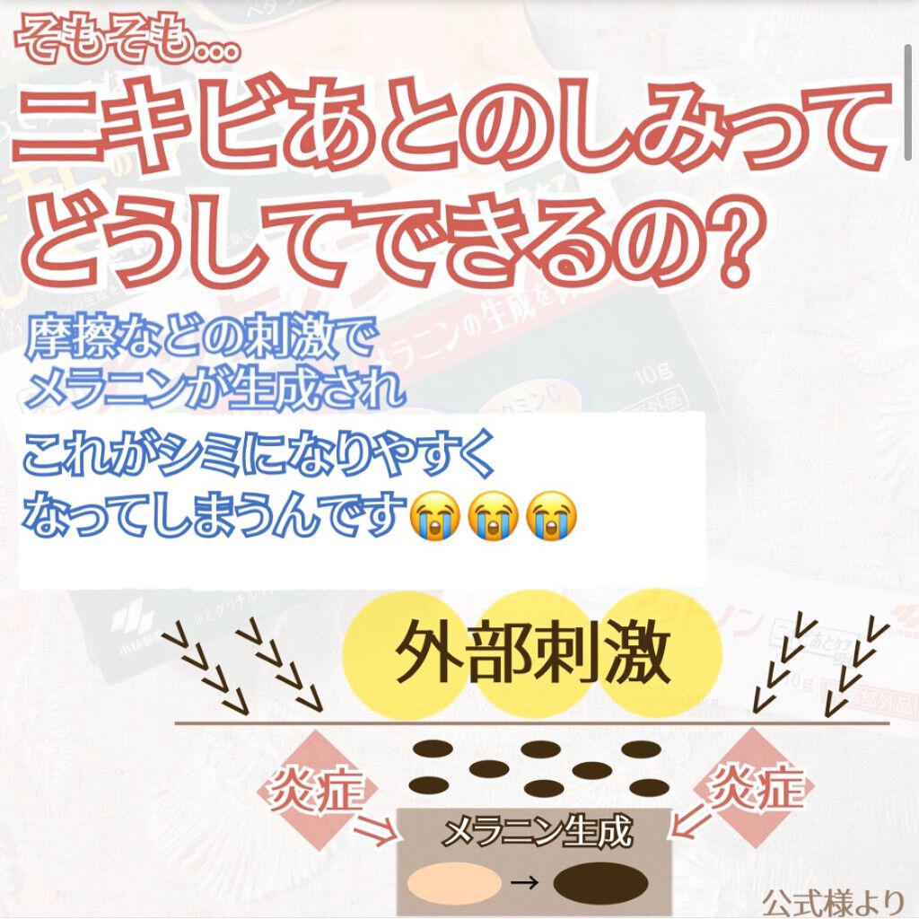 ニキビあとケアジェル/アットノン/その他スキンケアを使ったクチコミ(5枚目)