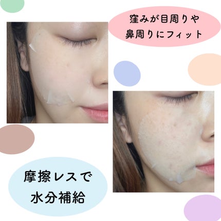 センテラ クイックカーミングパッド/SKIN1004/トナーパッドを使ったクチコミ(3枚目)