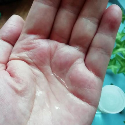 アクネケア 化粧液 <医薬部外品>/ファンケル/化粧水を使ったクチコミ(2枚目)