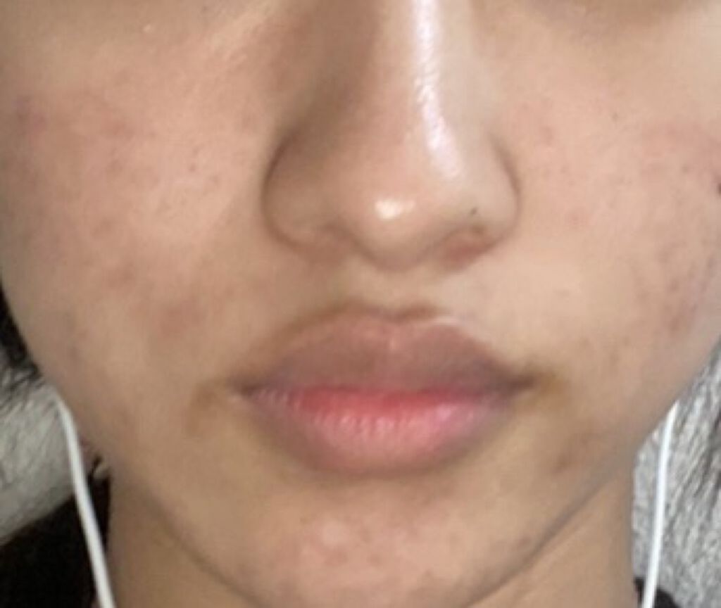 ダノンオイコス　脂肪0（ゼロ）	/オイコス/ヨーグルトを使ったクチコミ（2枚目）