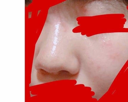 ワンステップオリジナルクリアパッド/COSRX/トナーパッドを使ったクチコミ(2枚目)