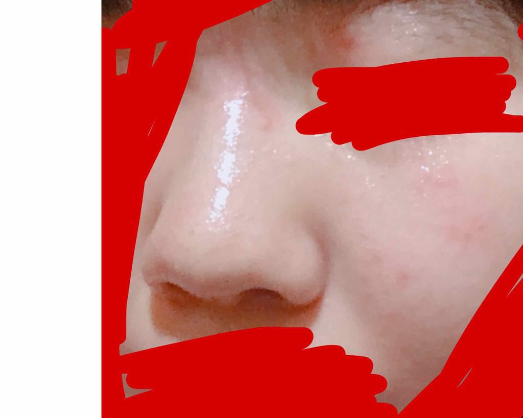 ワンステップオリジナルクリアパッド/COSRX/トナーパッドを使ったクチコミ(2枚目)