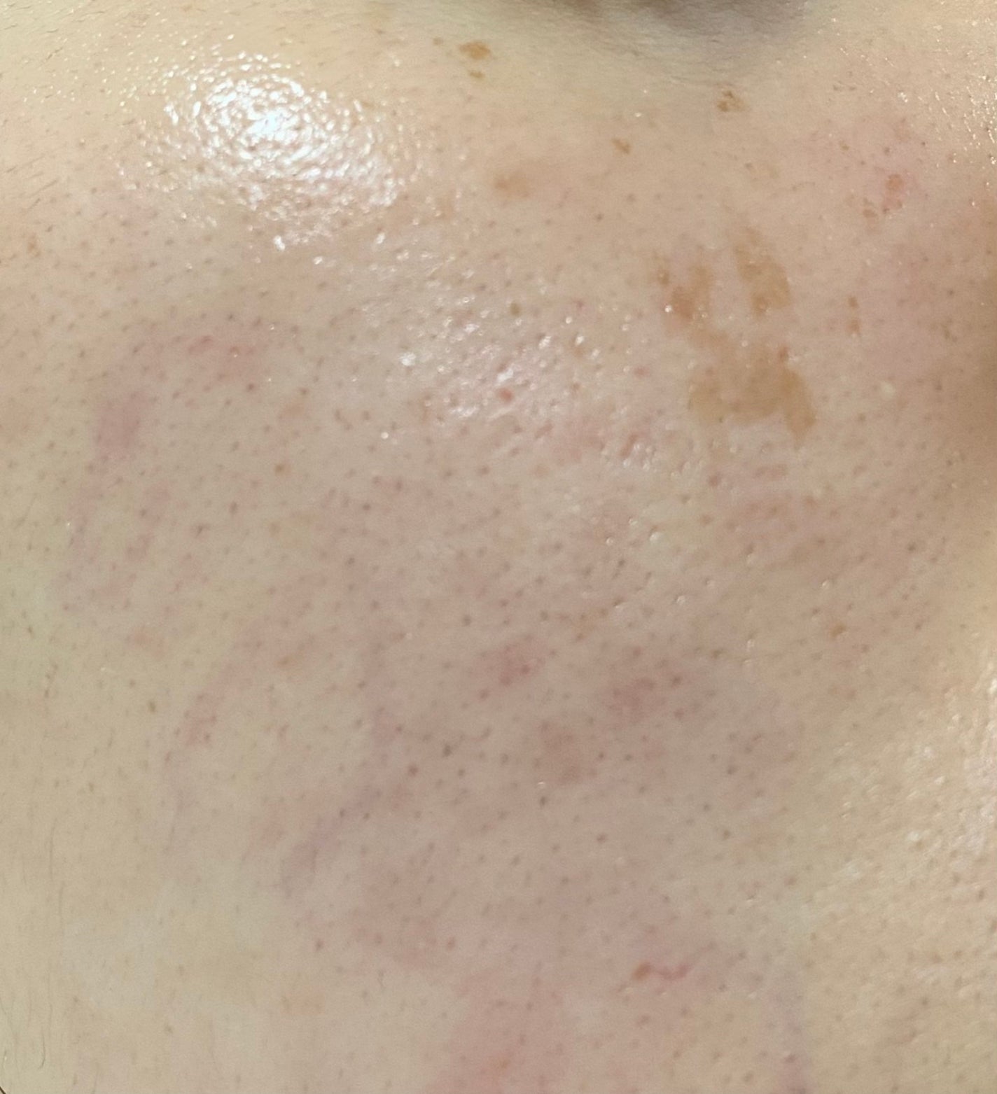 Rエッセンス/unlabel/美容液を使ったクチコミ(2枚目)