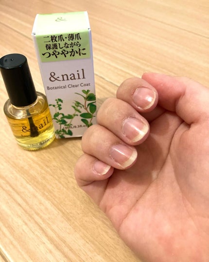 アンドネイルボタニカルクリアコート/BOTANICAL/ネイルオイル・トリートメントを使ったクチコミ(2枚目)