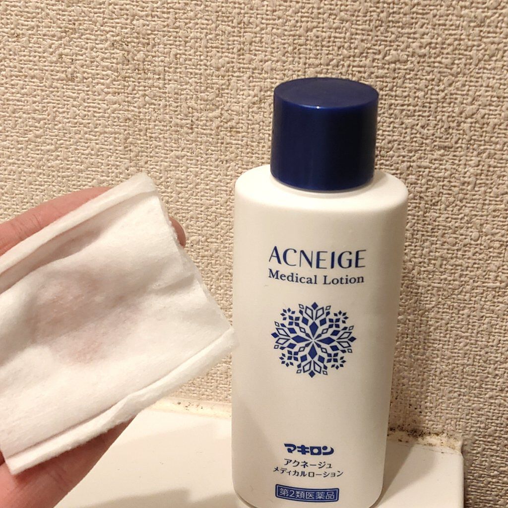 マキロン アクネージュ メディカルローション	（医薬品）/マキロン/その他を使ったクチコミ（2枚目）