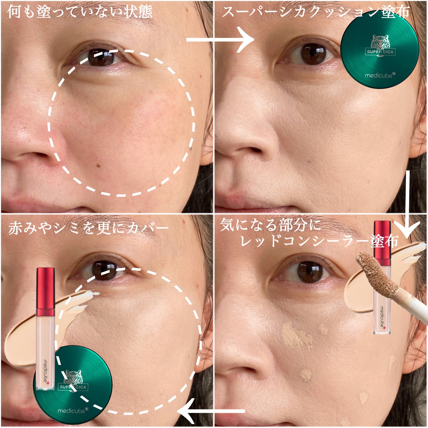 レッドコンシーラー/MEDICUBE/リキッドコンシーラーを使ったクチコミ(9枚目)