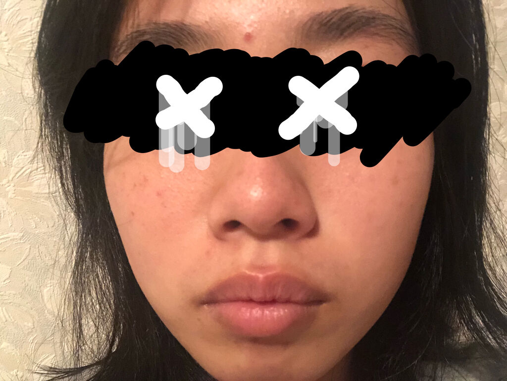 艶肌ドロップ/ラッシュ/美容液を使ったクチコミ（3枚目）