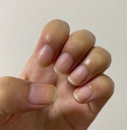 自爪補強コート/デュカート/ネイルベースコートを使ったクチコミ(3枚目)