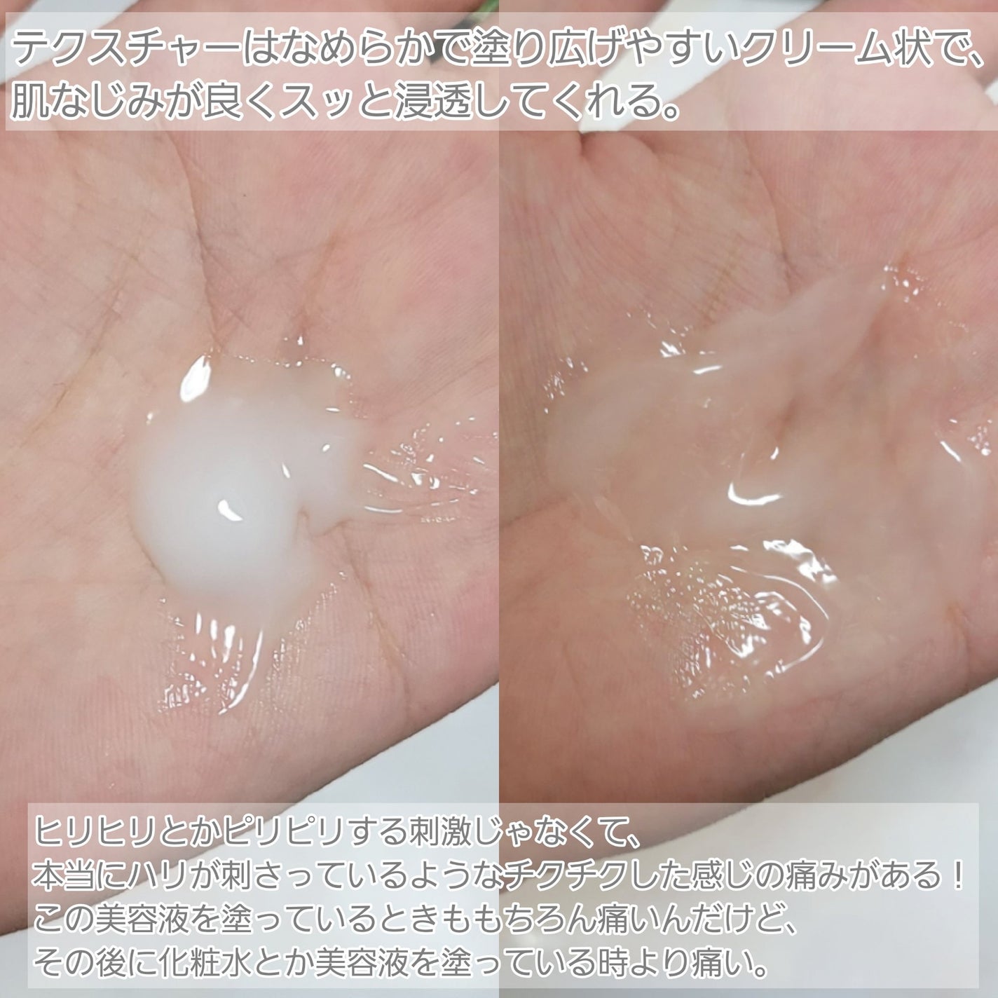 リードルショット100/VT/美容液を使ったクチコミ(4枚目)